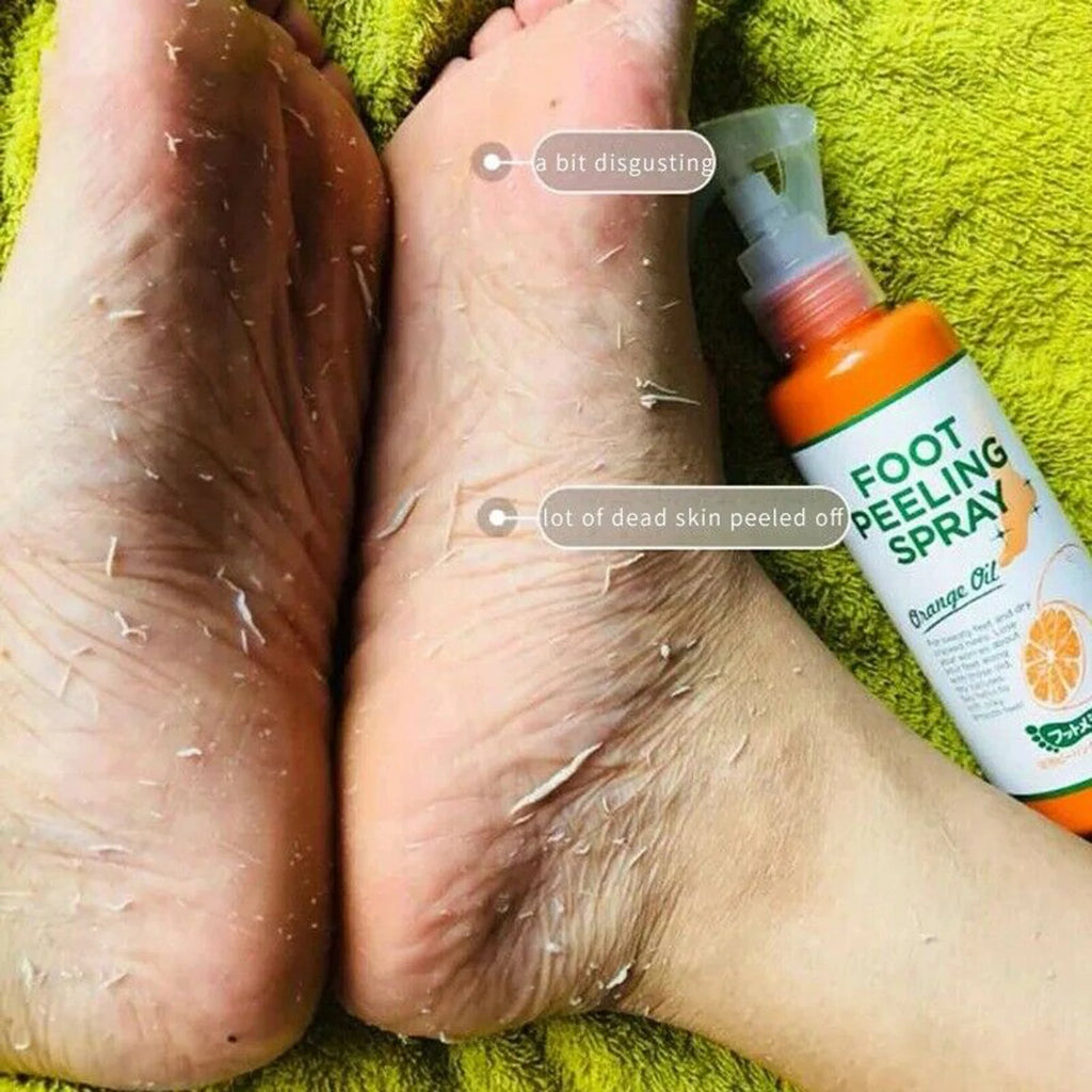 Spray Exfoliant Pied 110ml – Gommage & Élimination des Peaux Mortes